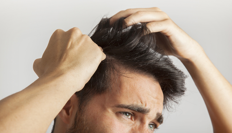 Saç Dökülmesi Doğuştan Gelen Sorun Mudur?